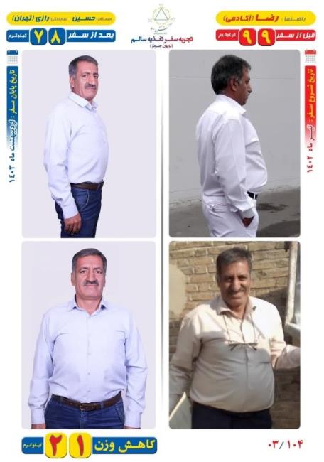 21 کیلو کاهش وزن مسافر حسین با روش Dezhakam