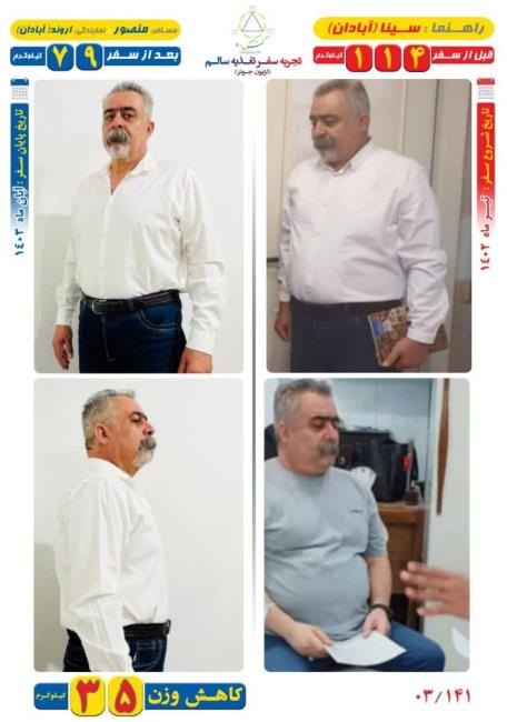 35 کیلوگرم کاهش وزن مسافر منصور به روش Dezhakam 
