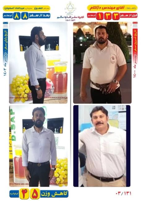 45 کیلوگرم کاهش وزن مسافر حسین به روش Dezhakam 